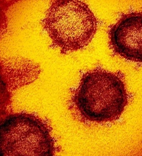 Santa Helena tem primeiro caso de coronavírus.