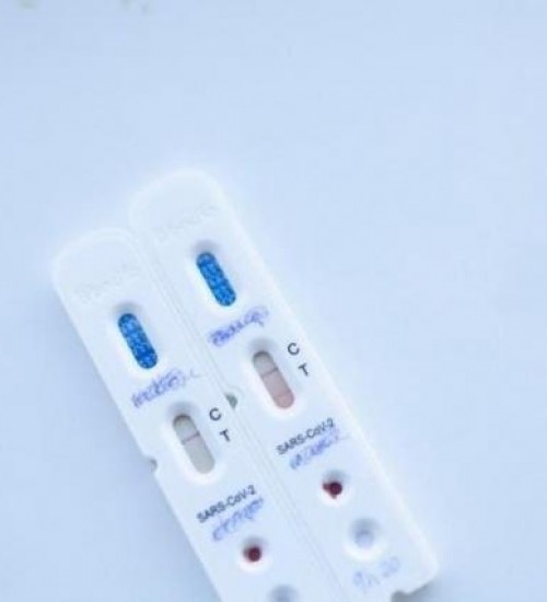 Testes de coronavírus são autorizados em farmácias de Santa Catarina.
