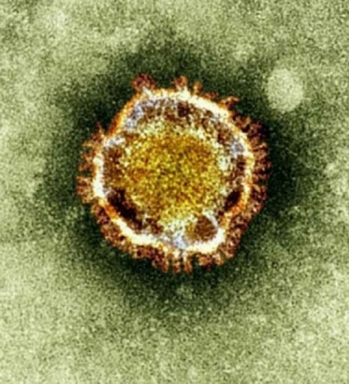 Coronavírus, Covid-19, Sars-Cov-2 e mais: veja a explicação para 16 termos usados na pandemia.