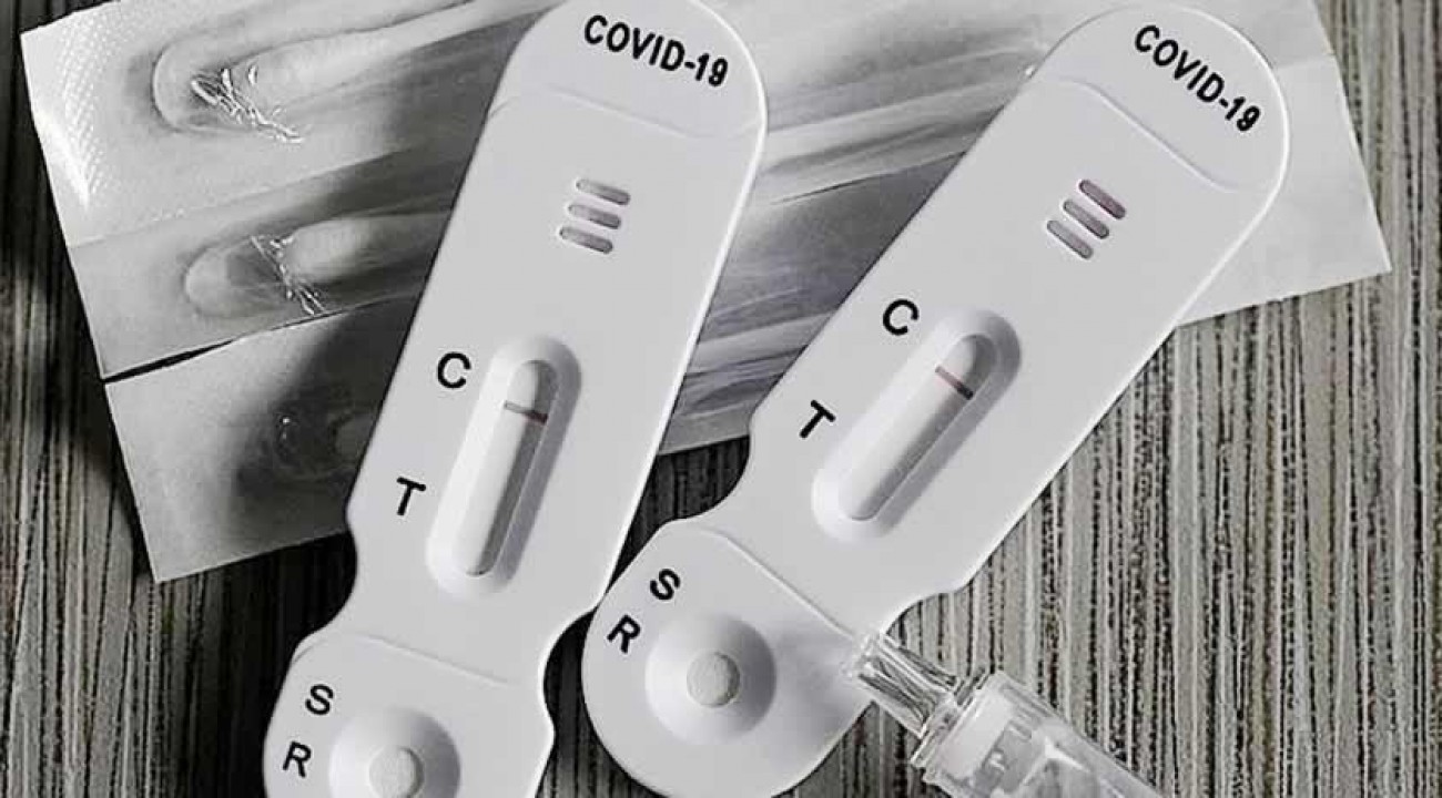 Farmácias de SC começam a vender autotestes de Covid-19 nos próximos dias.