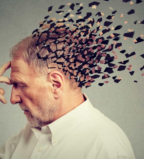 Alzheimer: por que o Brasil deve se preocupar mais com a doença do que a Europa?.