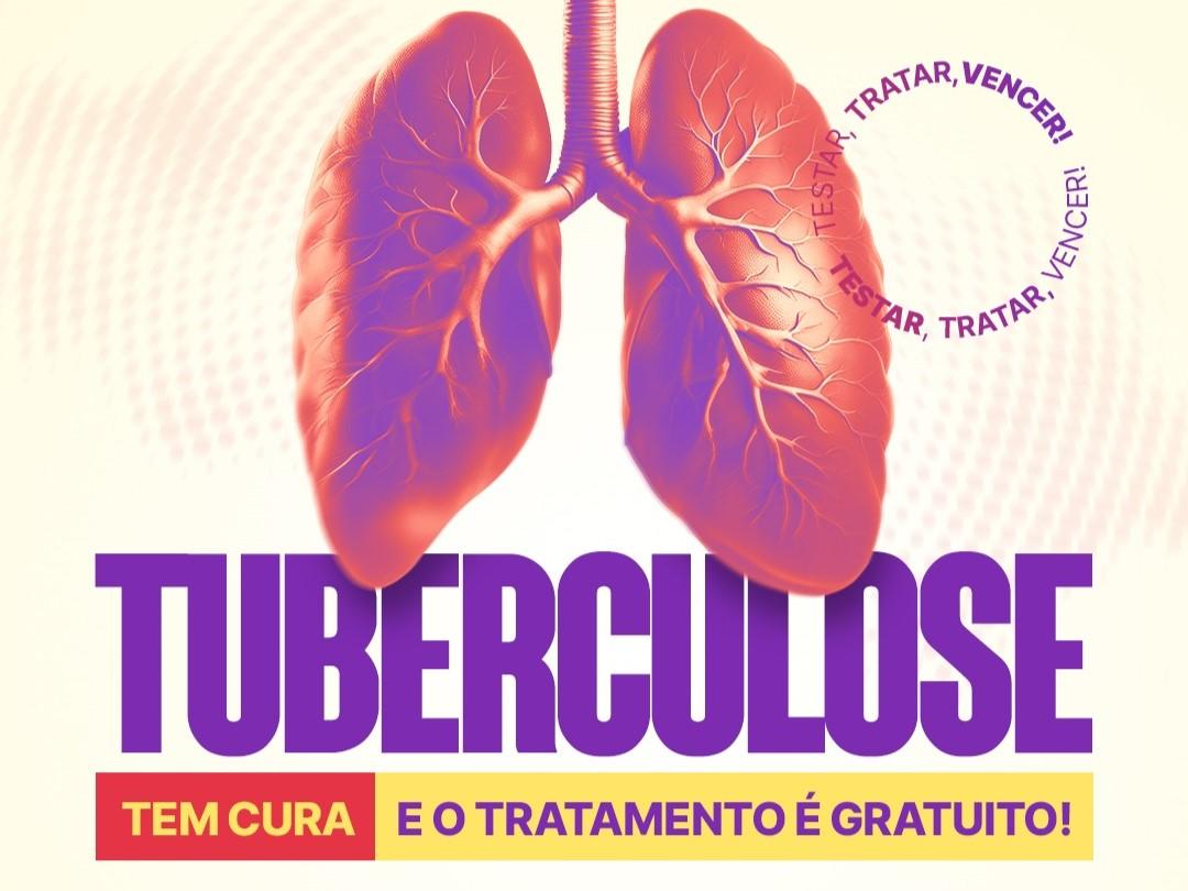 Saúde reforça a importância do diagnóstico precoce e tratamento da Tuberculose